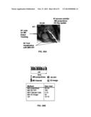 Robotic Device and Systems for Image-Guided and Robot-Assisted Surgery diagram and image