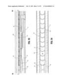 APPARATUS FOR APPLYING SURGICAL CLIPS diagram and image