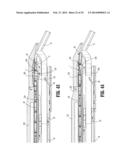 APPARATUS FOR APPLYING SURGICAL CLIPS diagram and image