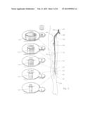 ATHERECTOMY APPARATUS, SYSTEMS AND METHODS diagram and image