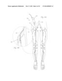 ATHERECTOMY APPARATUS, SYSTEMS AND METHODS diagram and image