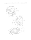 ATHERECTOMY APPARATUS, SYSTEMS AND METHODS diagram and image