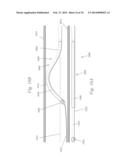 ATHERECTOMY APPARATUS, SYSTEMS AND METHODS diagram and image