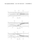 ATHERECTOMY APPARATUS, SYSTEMS AND METHODS diagram and image