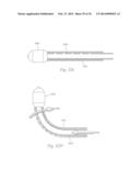 ATHERECTOMY APPARATUS, SYSTEMS AND METHODS diagram and image