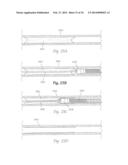 ATHERECTOMY APPARATUS, SYSTEMS AND METHODS diagram and image