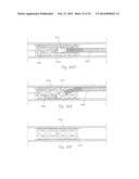 ATHERECTOMY APPARATUS, SYSTEMS AND METHODS diagram and image