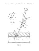 BIOADHESIVE MIXING AND DELIVERY DEVICE AND METHODS diagram and image