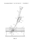 BIOADHESIVE MIXING AND DELIVERY DEVICE AND METHODS diagram and image