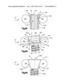 Bone Fixation System diagram and image