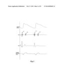 PULSE DETECTION USING PATIENT PHYSIOLOGICAL SIGNALS diagram and image