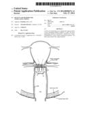 DEVICES AND METHODS FOR STIMULATING NERVES diagram and image