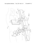 ANTERIOR PELVIC SUPPORT DEVICE FOR A SURGERY PATIENT diagram and image