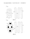 INTRAVENOUS EXTREMITY SUPPORT diagram and image