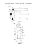 INTRAVENOUS EXTREMITY SUPPORT diagram and image