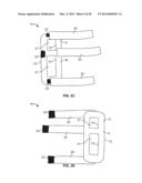 INTRAVENOUS EXTREMITY SUPPORT diagram and image