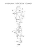 INTRAVENOUS EXTREMITY SUPPORT diagram and image