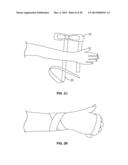 INTRAVENOUS EXTREMITY SUPPORT diagram and image