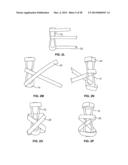 INTRAVENOUS EXTREMITY SUPPORT diagram and image