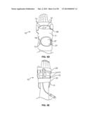 INTRAVENOUS EXTREMITY SUPPORT diagram and image