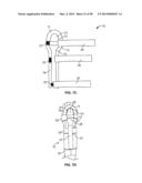 INTRAVENOUS EXTREMITY SUPPORT diagram and image