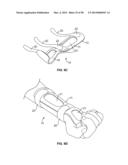 INTRAVENOUS EXTREMITY SUPPORT diagram and image