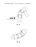 INTRAVENOUS EXTREMITY SUPPORT diagram and image