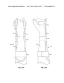 INTRAVENOUS EXTREMITY SUPPORT diagram and image