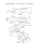 INTRAVENOUS EXTREMITY SUPPORT diagram and image