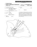 TIRE BEAD WEDGE PLIERS diagram and image