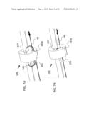 CATHODIC PROTECTION MONITORING METHOD, SYSTEM AND COMPONENTS diagram and image