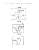 MEDICAL IMAGE DIAGNOSTIC APPARATUS, MEDICAL IMAGE PROCESSING APPARATUS,     AND METHODS THEREFOR diagram and image