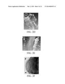 METHOD OF TRACKING GROWTH AND METASTASIS OF SPECIFIC CELLS IN VIVO diagram and image