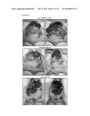 Inhibition of AXL Signaling in Anti-Metastatic Therapy diagram and image