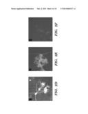 NEURAL STEM CELLS DERIVED FROM INDUCED PLURIPOTENT STEM CELLS diagram and image