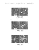 NEURAL STEM CELLS DERIVED FROM INDUCED PLURIPOTENT STEM CELLS diagram and image