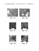 NEURAL STEM CELLS DERIVED FROM INDUCED PLURIPOTENT STEM CELLS diagram and image