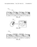 METHOD OF CHARACTERIZING TISSUE OF A PATIENT diagram and image