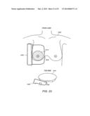 VERSATILE BREAST ULTRASOUND SCANNING diagram and image