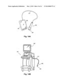 ATTACHMENT FOR ULTRASONIC PROBE, ULTRASONIC PROBE, ELECTRONIC DEVICE, AND     ULTRASONIC DIAGNOSTIC APPARATUS diagram and image