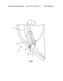 METHODS, APPARATUSES, AND SYSTEMS FOR REDUCING INTRAOCULAR PRESSURE AS A     MEANS OF PREVENTING OR TREATING OPEN-ANGLE GLAUCOMA diagram and image