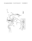 METHODS, APPARATUSES, AND SYSTEMS FOR REDUCING INTRAOCULAR PRESSURE AS A     MEANS OF PREVENTING OR TREATING OPEN-ANGLE GLAUCOMA diagram and image