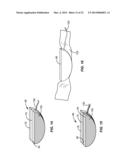 METHODS, APPARATUSES, AND SYSTEMS FOR REDUCING INTRAOCULAR PRESSURE AS A     MEANS OF PREVENTING OR TREATING OPEN-ANGLE GLAUCOMA diagram and image