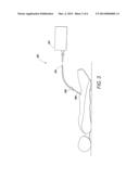 High-Flow Luer Lock Connector for a Luer Lock Connection diagram and image