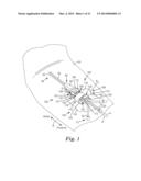 MEDICAL ARTICLE SECUREMENT SYSTEMS COMPRISING A BRACKET AND A FLAP diagram and image