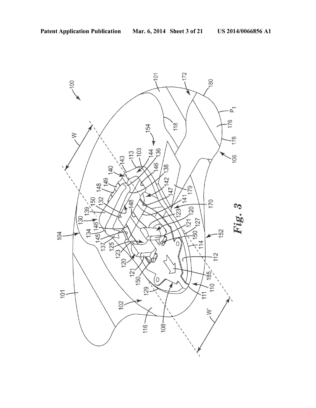 MEDICAL ARTICLE SECUREMENT SYSTEMS COMPRISING A BRACKET AND A FLAP - diagram, schematic, and image 04