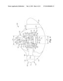 MEDICAL ARTICLE SECUREMENT SYSTEMS COMPRISING A BRACKET AND A FLAP diagram and image