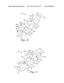 MEDICAL ARTICLE SECUREMENT SYSTEMS COMPRISING A BRACKET AND A FLAP diagram and image