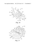 MEDICAL ARTICLE SECUREMENT SYSTEMS COMPRISING A BRACKET AND A FLAP diagram and image