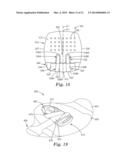 MEDICAL ARTICLE SECUREMENT SYSTEMS COMPRISING A BRACKET AND A FLAP diagram and image